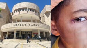 ilkokul ogrencisinin yuzunde sigara sondurdu temizlik gorevlisi tutuklandi 6Kgry6hO.jpg